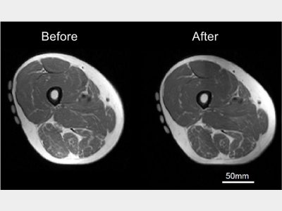 Hypertrophy of thigh muscles (quadriceps femoris) after a 3-mo LST program in the elderly.