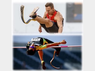 Amputee long jumper (upper) and amputee high jumper. (lower) whose brains appeared to be reorganized during long-term intensive training to improve their performance.