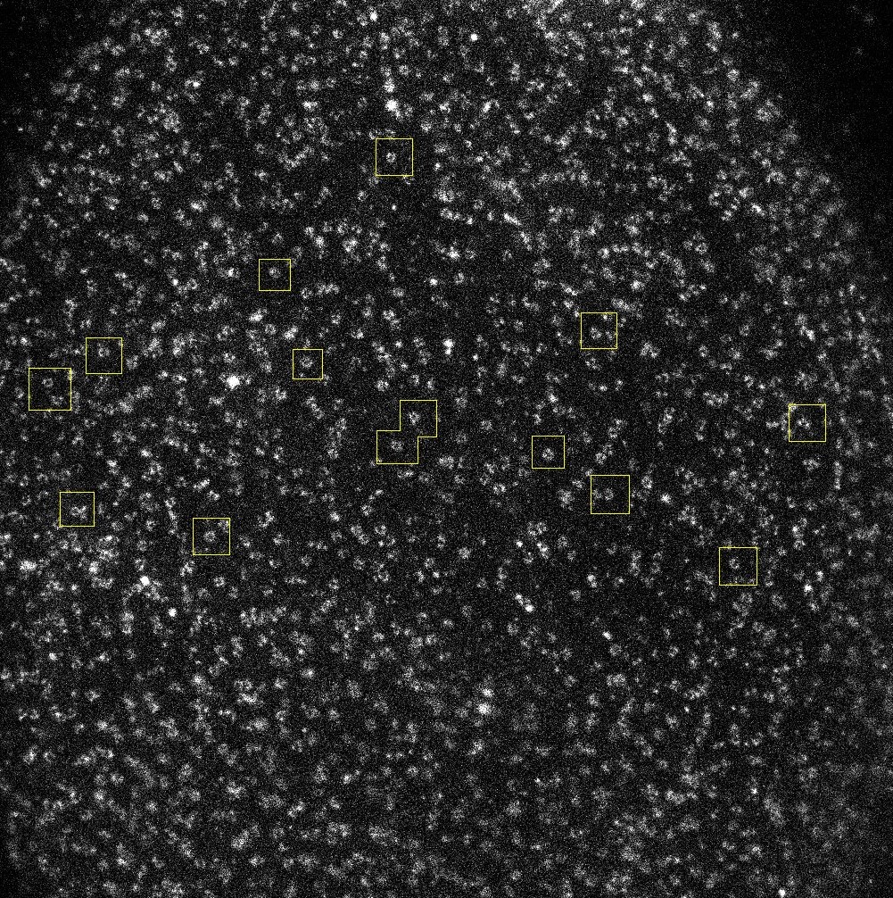 Super-resolution imaging of nuclear pore