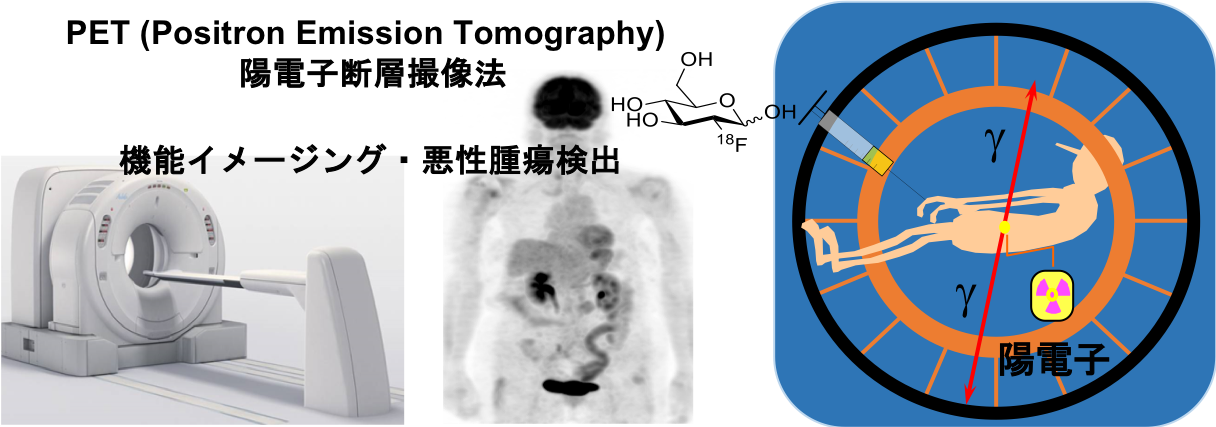PETイメージング装置と原理