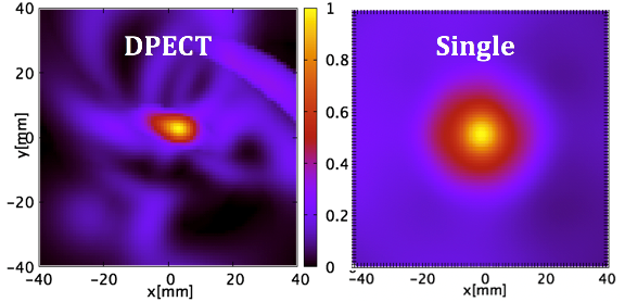 DPECT（Double Photon Emission CT）と単光子画像の比較