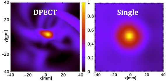 Reconstructed image comparison between double-photon (DPECT) and single photon method.