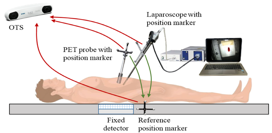 Proposed new intraoperative imaging method