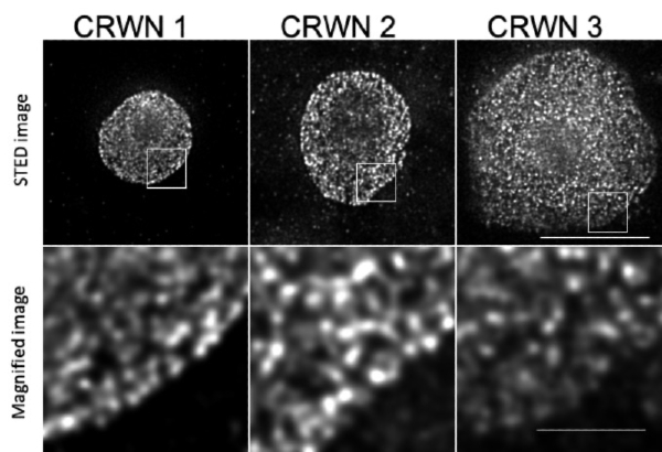 Stimulate emission-depleting microscope images of three plant cell nuclei, each showing the entire nucleus and an enlarged section. 