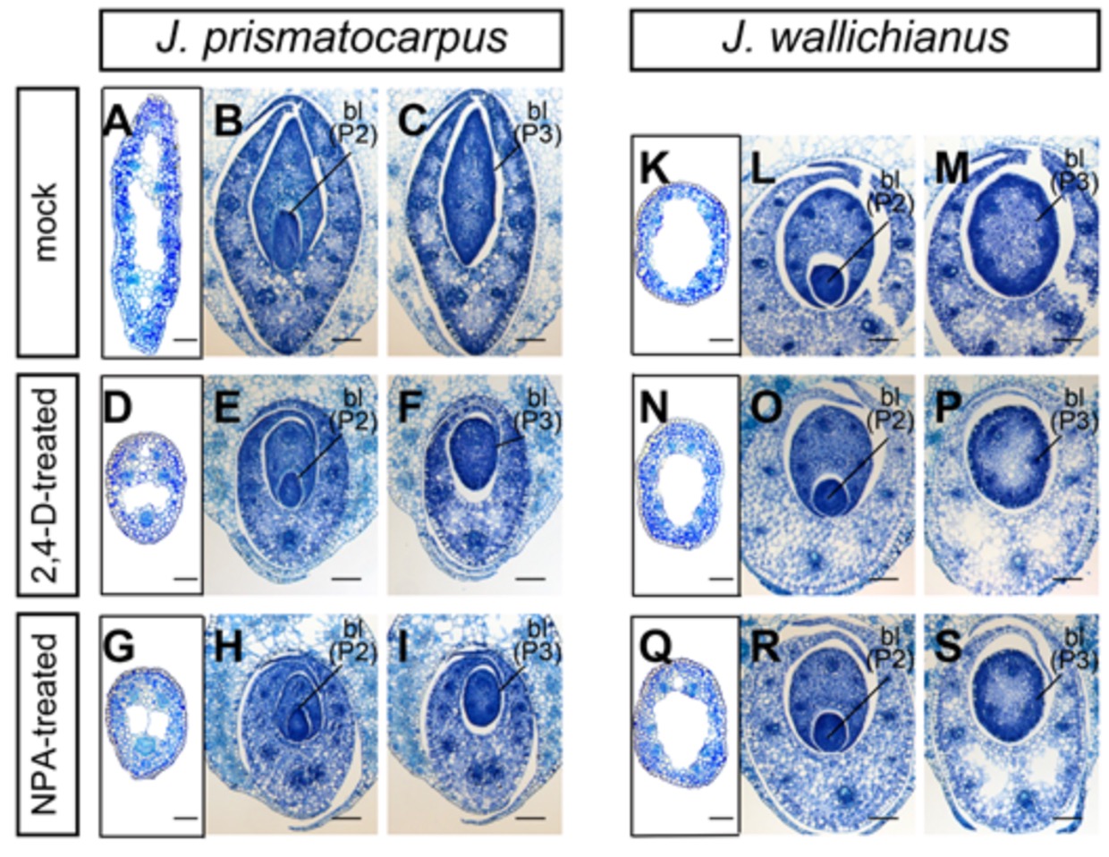 Microscopy images of J. prismatocarpus and J. wallichianus