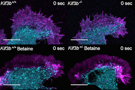 Four videos, each showing a single neuron under a fluorescent microscope. Cyan or blue color marks microtubules. Pink color marks filamentous actin.