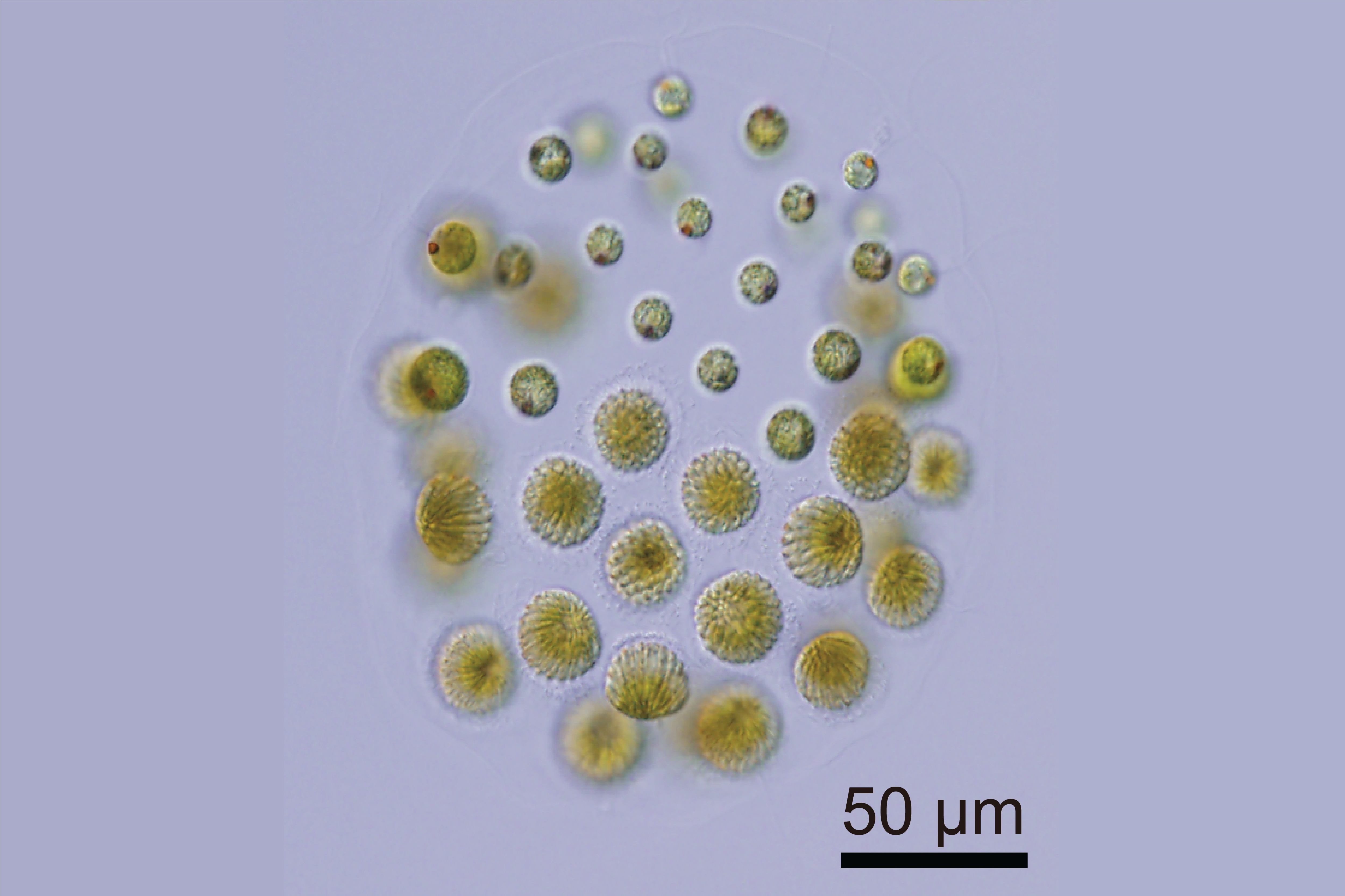 Light microscope image of green algae cells. 