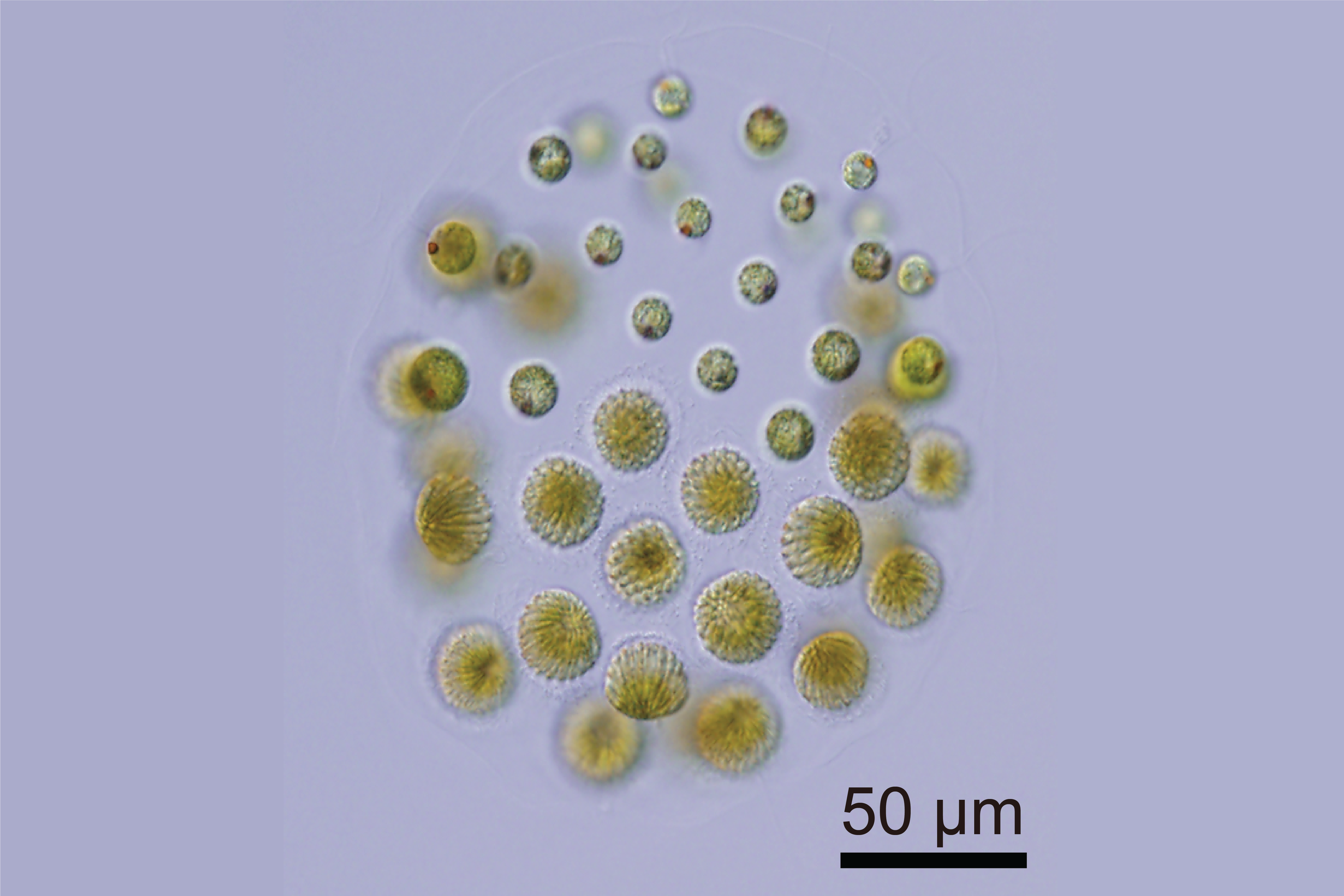 Light microscope image of green algae cells.