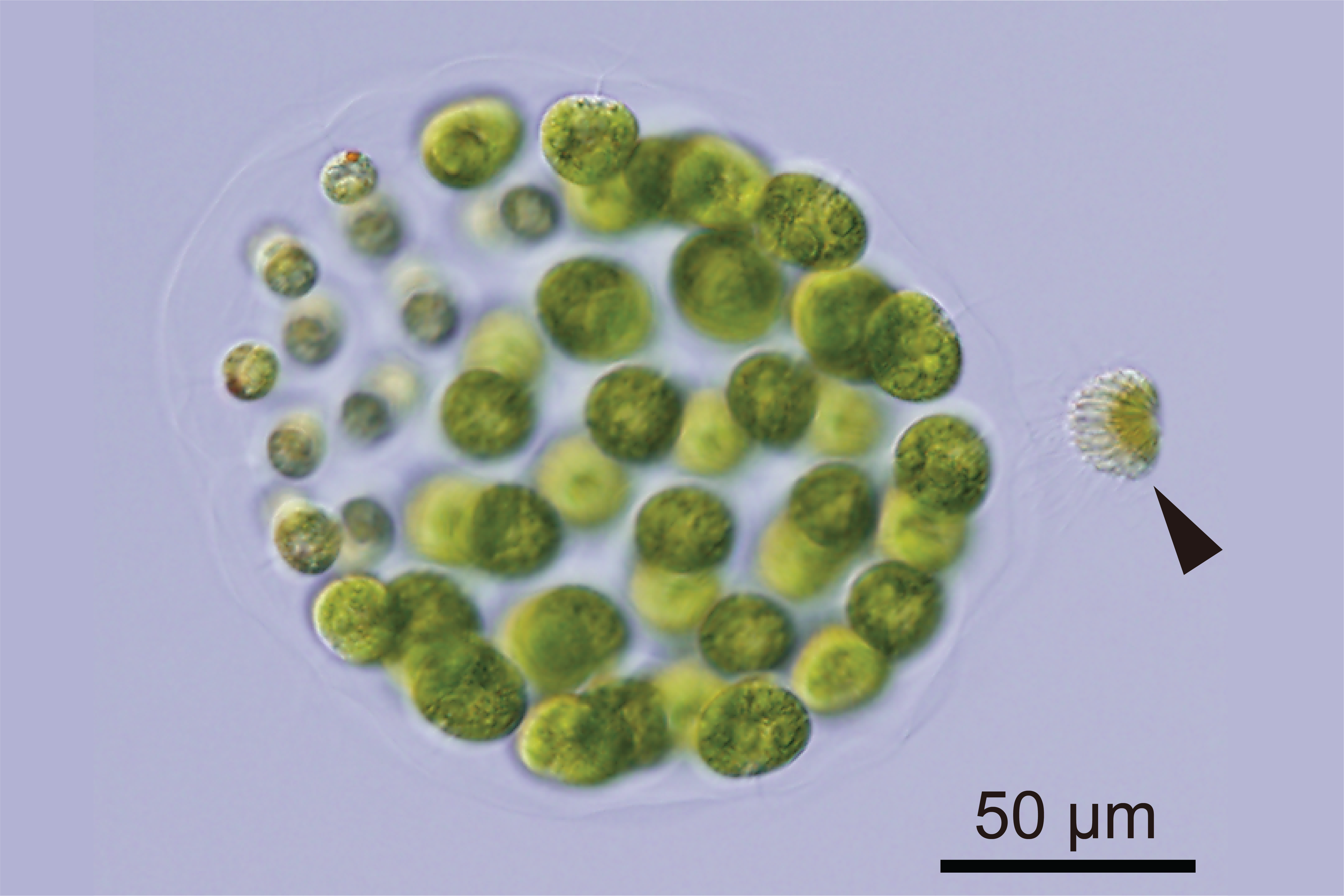 Light microscope image of green algae cells with a male sperm packet on the right side of the image.