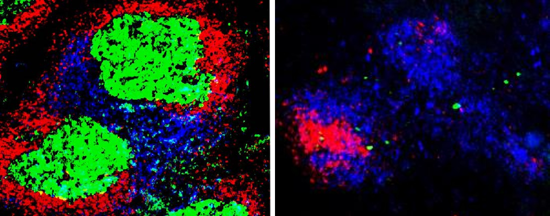 Fluorescent microscopy of T and B cells showing germinal center forming in spleen after malaria infection only in a TBK1 positive mouse