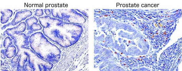 Images of normal prostate and prostate cancer cells