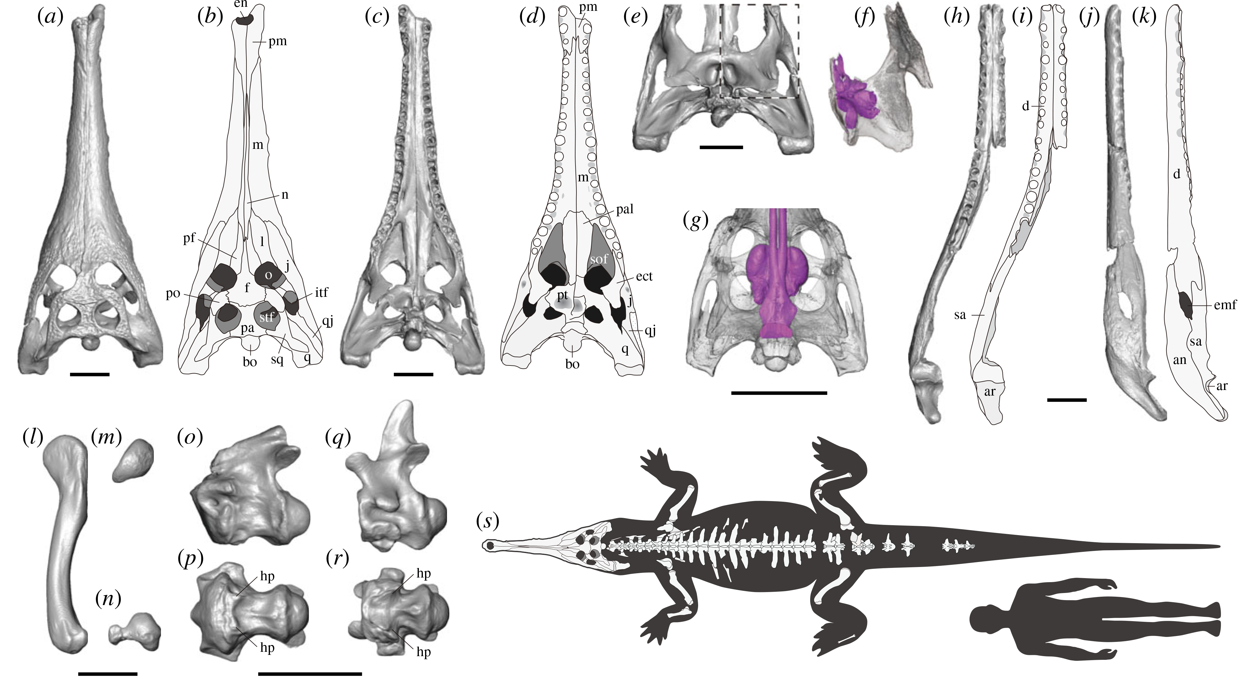 Illustrations of various bones