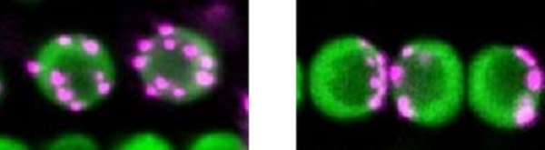 Photos of magenta centromere distribution in green plant cells