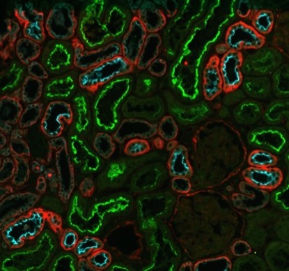 Colorful biomarker cells glowing green, red and blue against black.