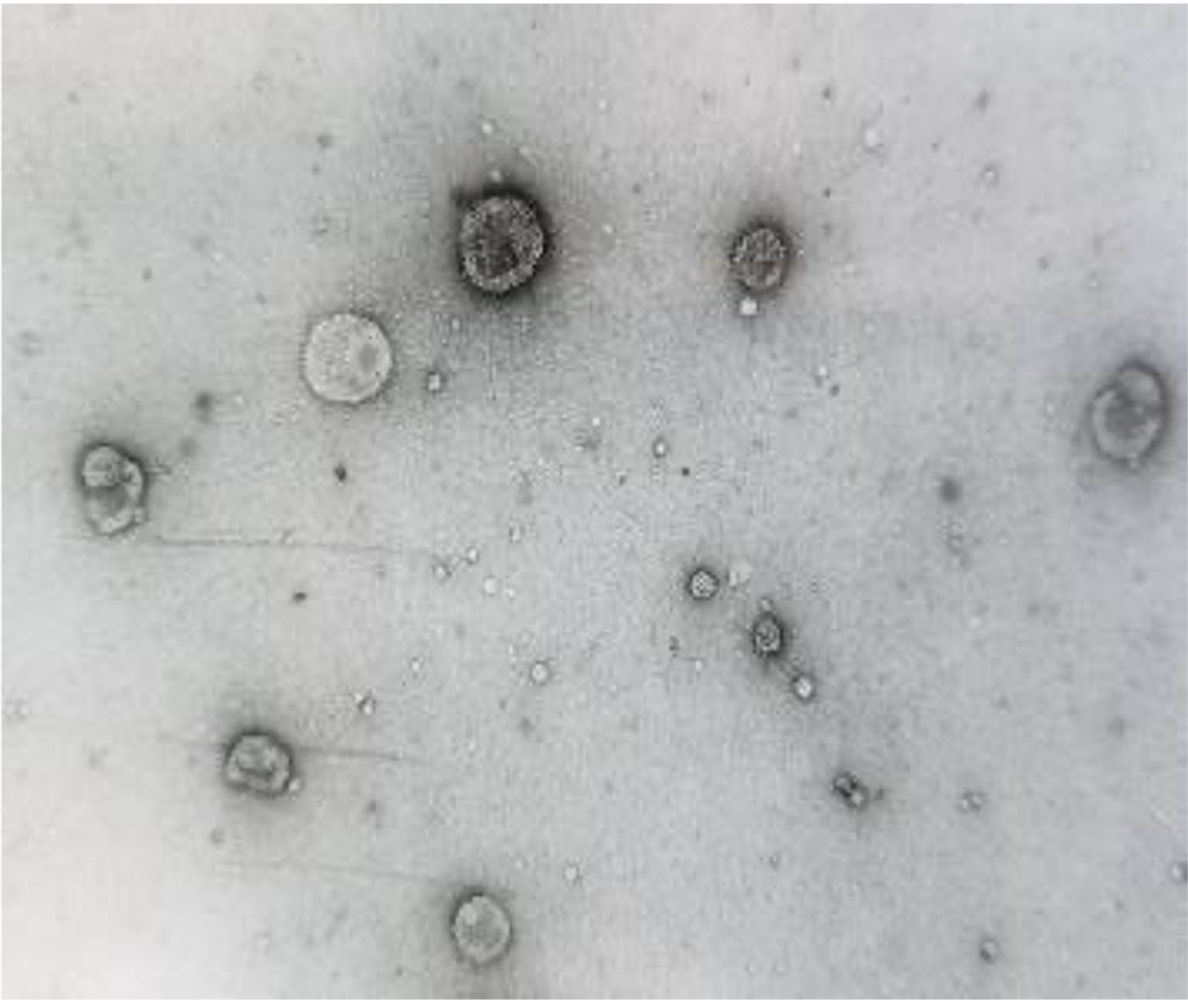 Greyscale image of urine extracellular vesicles.
