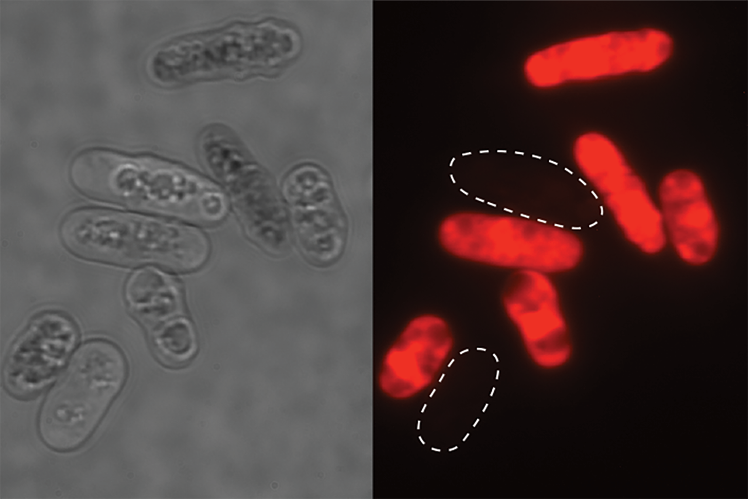 Poisoned yeast cells marked with a red dye against a black background.