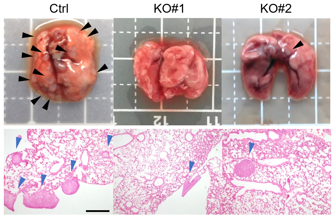 A row of photographs showing extracted tumor tissue.