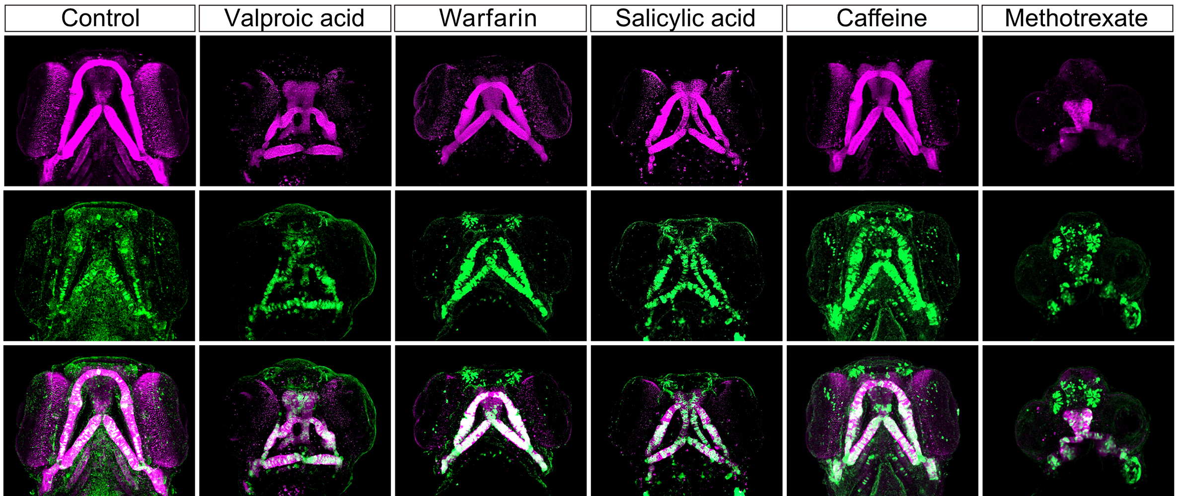 Images of the impact of five substances on zebrafish facial development, shown in purple and green fluorescent coloured features against black bagrounds.