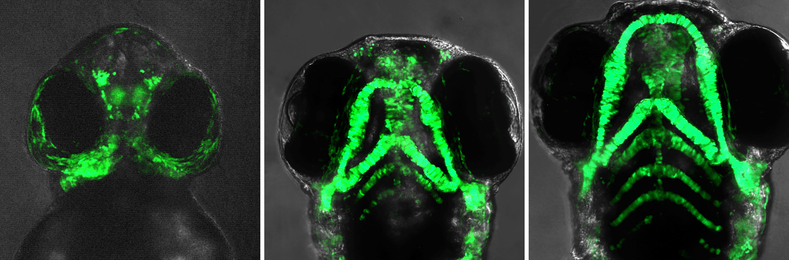 Three green fluorescent colored images showing growth of features of a zebrafish face over one to four days.