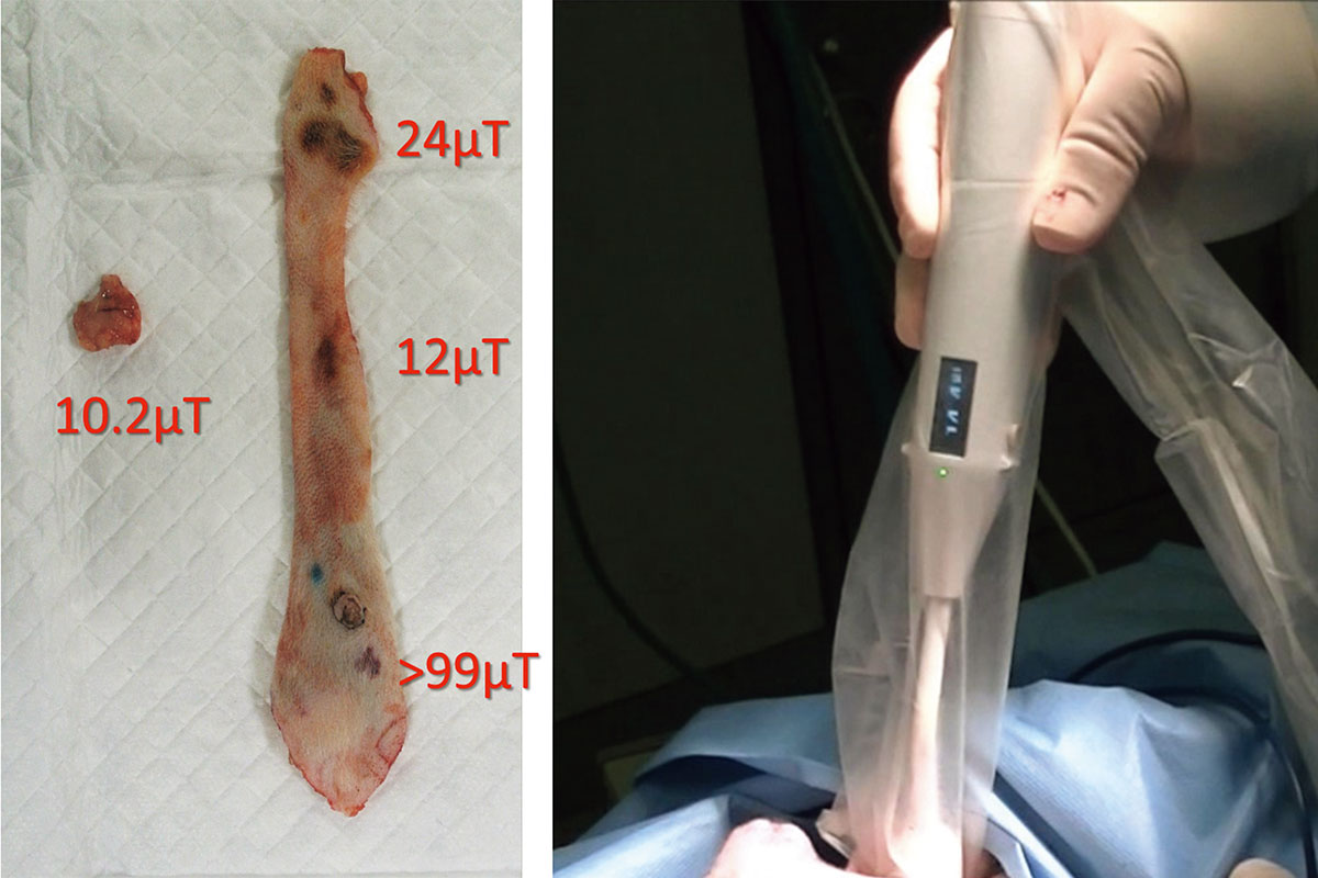 The small tissue on the left is a lymph node, and a removed mammary gland is shown on the right. (The numerical data show the magnetic sensor measurement results.)