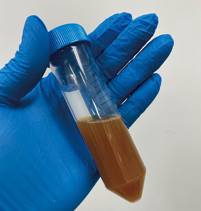 糞便移植治療に使われる、便を濾過した茶色い液体の見本