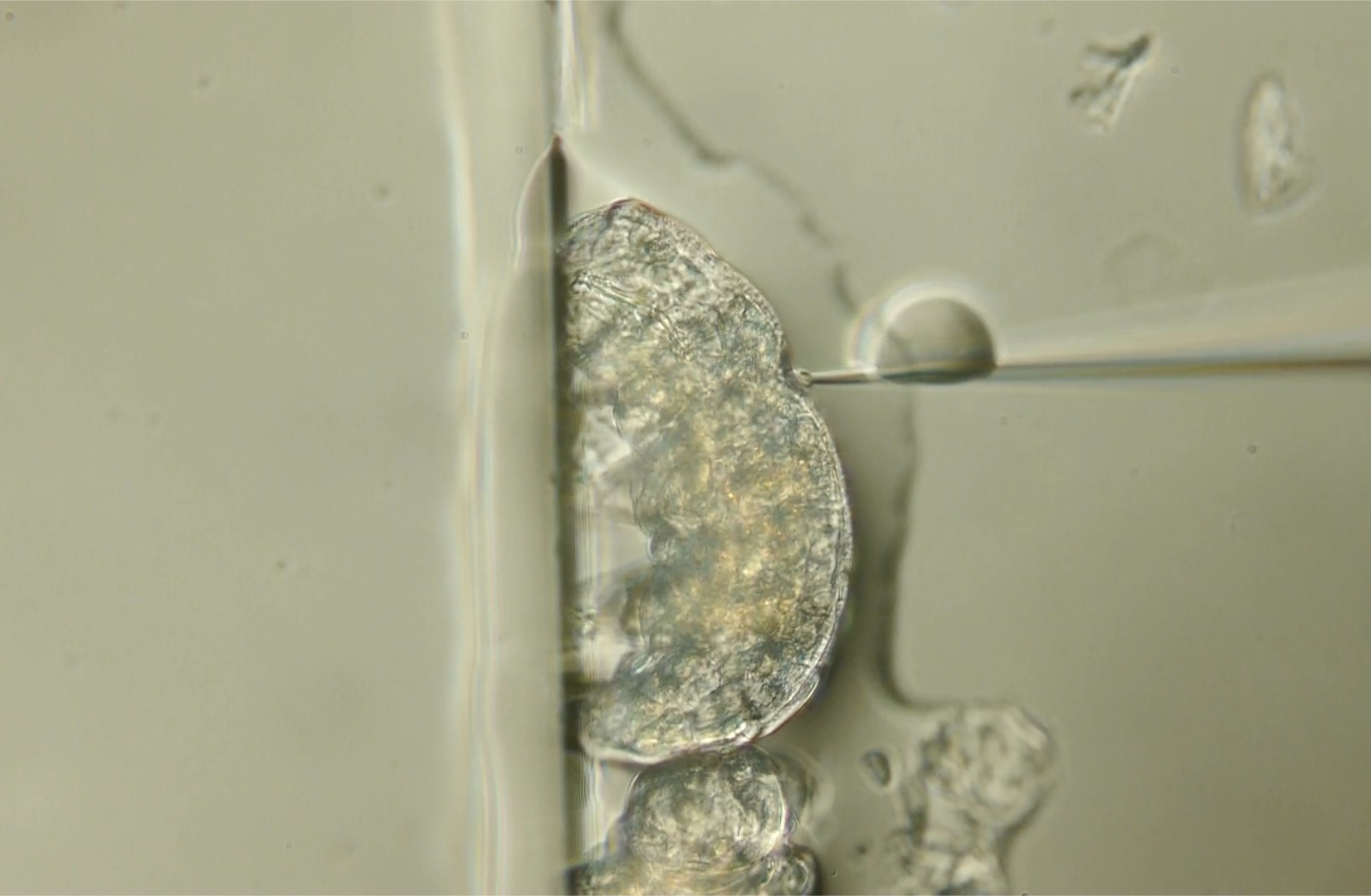 Microscope image of a translucent creature on a grey background.