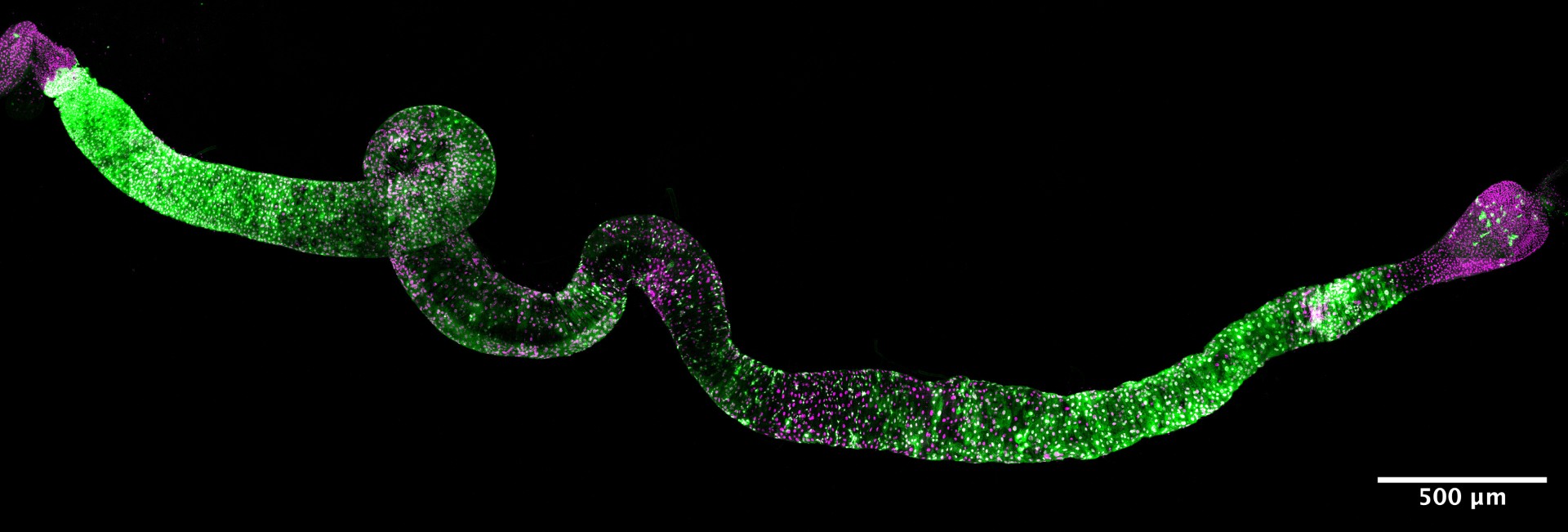 Black bakground, neon green worm like structure with pink ends.