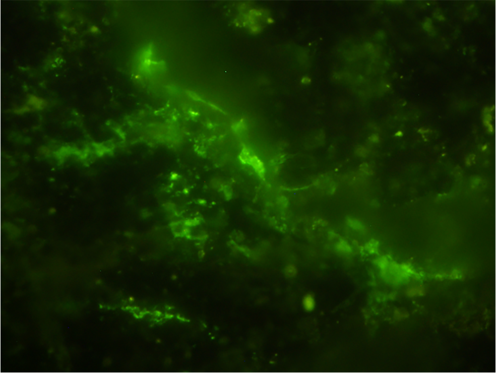 Fluorescent green microbes against a black background.