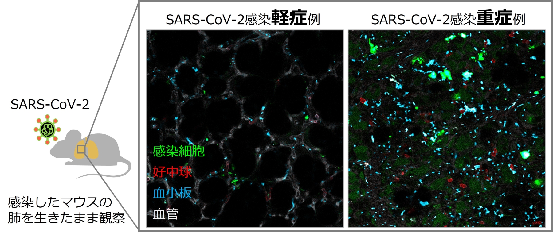 免疫細胞が引き起こすCOVID-19の重症化機序を解明～肺血管での異常な接着現象に着目～