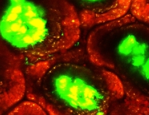 腸管マクロファージ